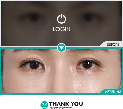 Before/After