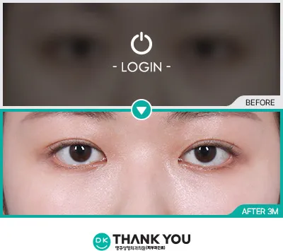Before/After