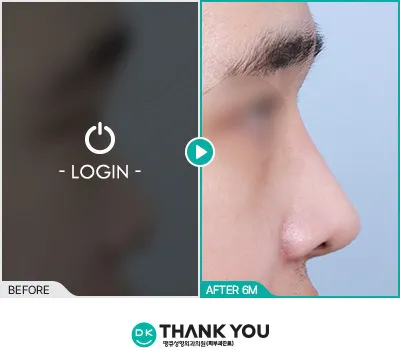 Before/After
