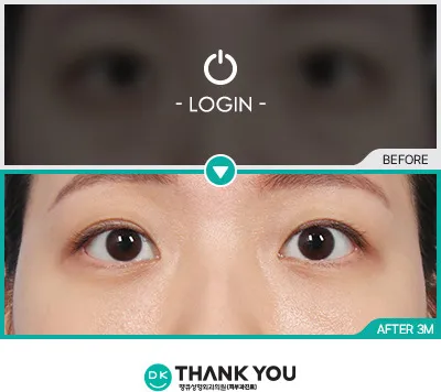 Before/After