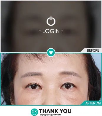 Before & After