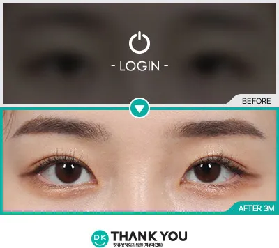 Before/After