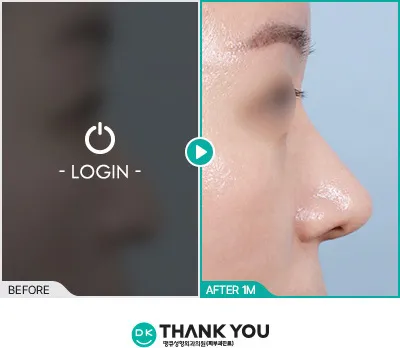 Before/After
