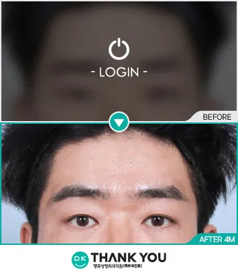 Before/After
