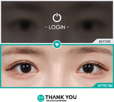 Before/After