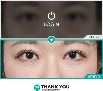 Before & After