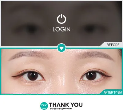 Before/After