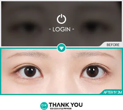 Before/After