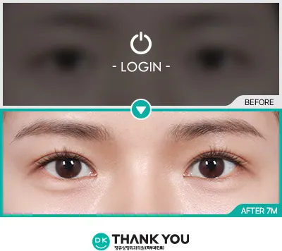 Before/After