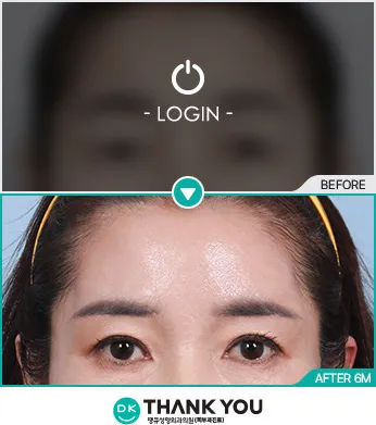 Before/After