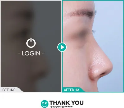 Before/After