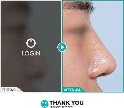 Before/After