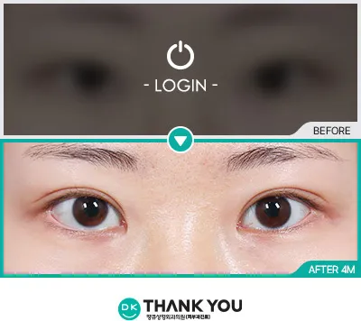 Before/After
