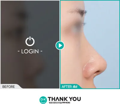 Before/After
