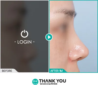 Before/After