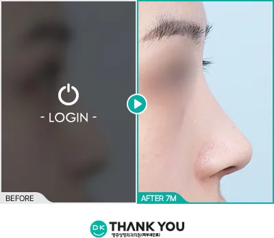 Before/After