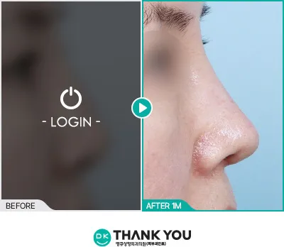 Before/After