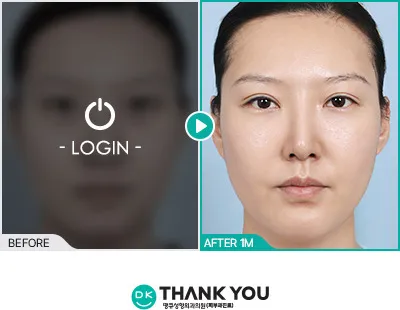 Before/After