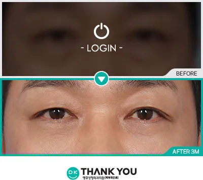 Before/After