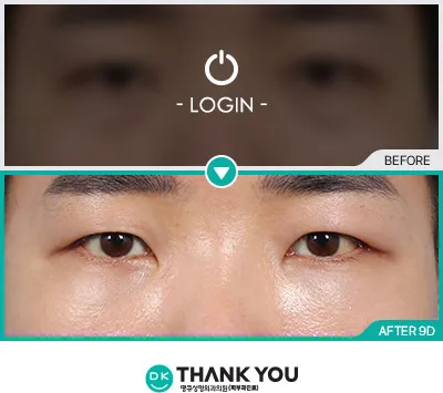 Before/After
