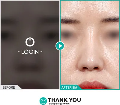 Before/After