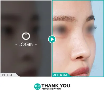 Before/After