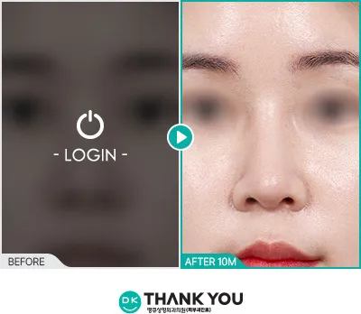Before/After