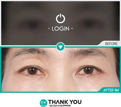 Before & After