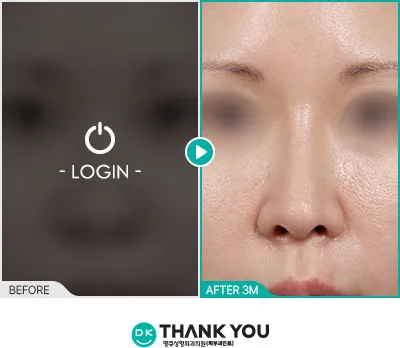 Before/After