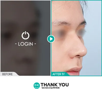 Before/After