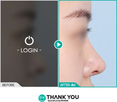 Before/After