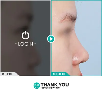 Before/After