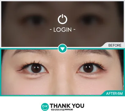 Before/After
