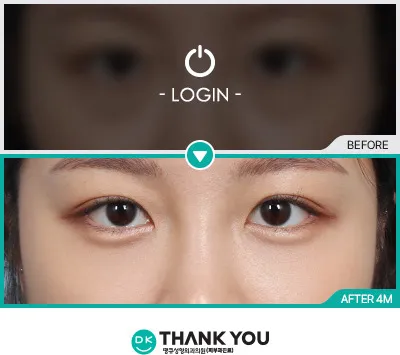 Before/After