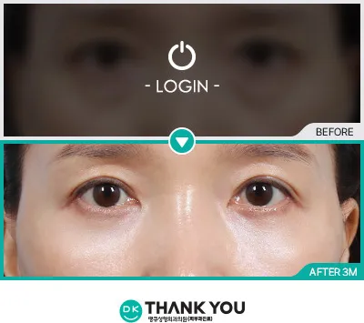 Before/After