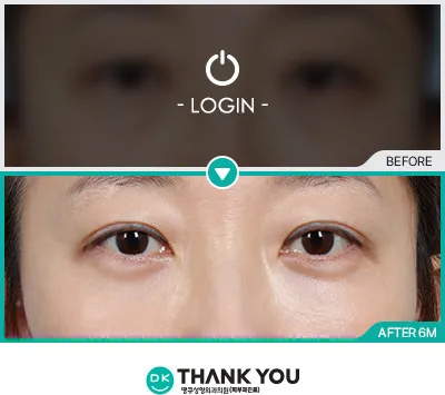 Before/After
