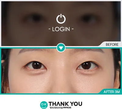 Before/After