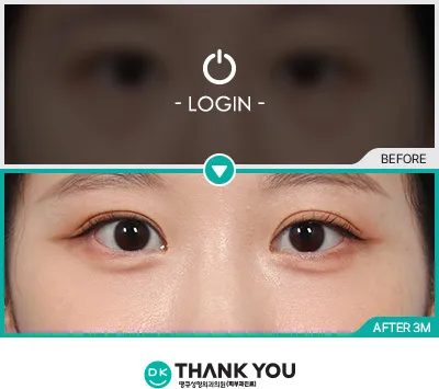Before/After