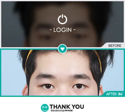 Before/After