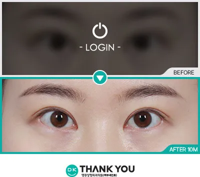 Before/After