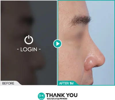 Before/After