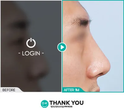 Before/After
