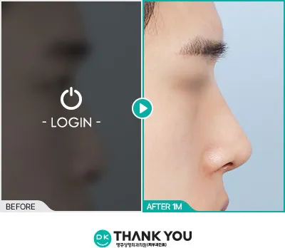 Before/After