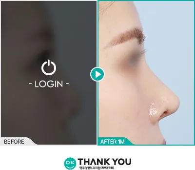Before/After
