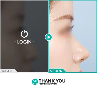 Before/After