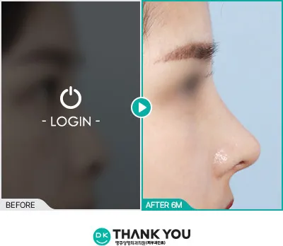 Before/After