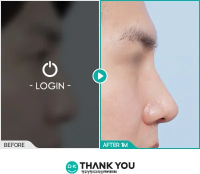 Before/After