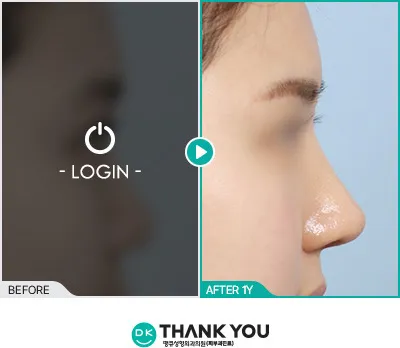 Before/After