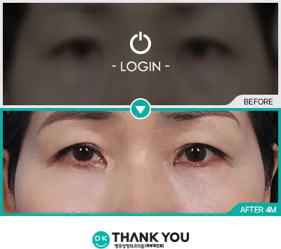 Before/After