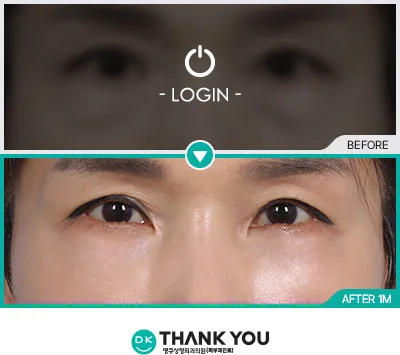 Before & After